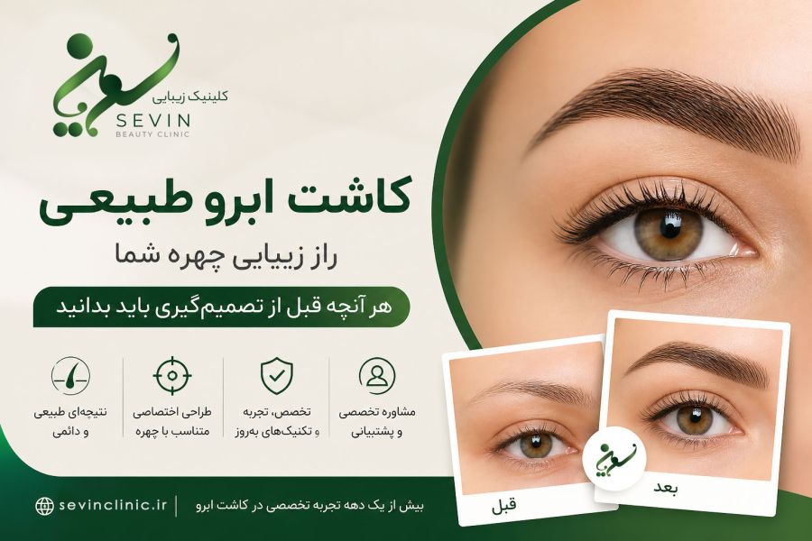 کاشت ابرو طبیعی؛ راز زیبایی چهره و آنچه قبل از تصمیم‌گیری باید بدانید