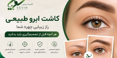 کاشت ابرو طبیعی؛ راز زیبایی چهره و آنچه قبل از تصمیم‌گیری باید بدانید